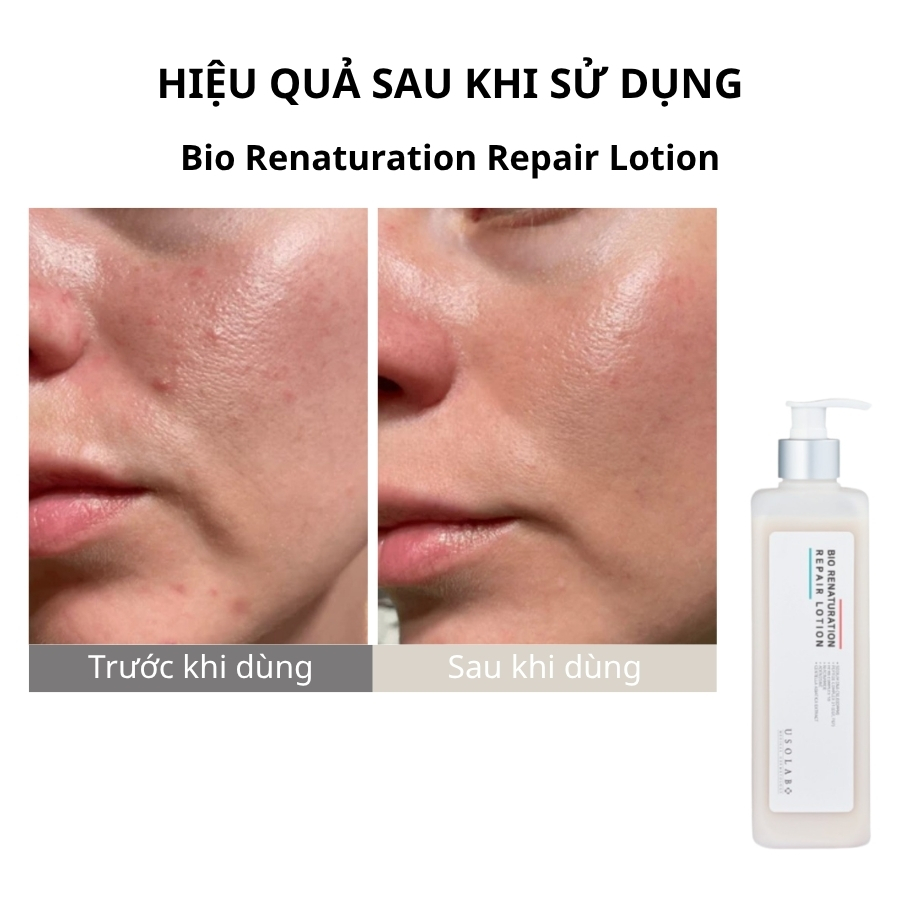 Lotion tế bào gốc cho da nhạy cảm, lão hóa Bio Renaturation Repair Lotion 500ml (Salon Size) 1 Bio Renaturation Repair Lotion