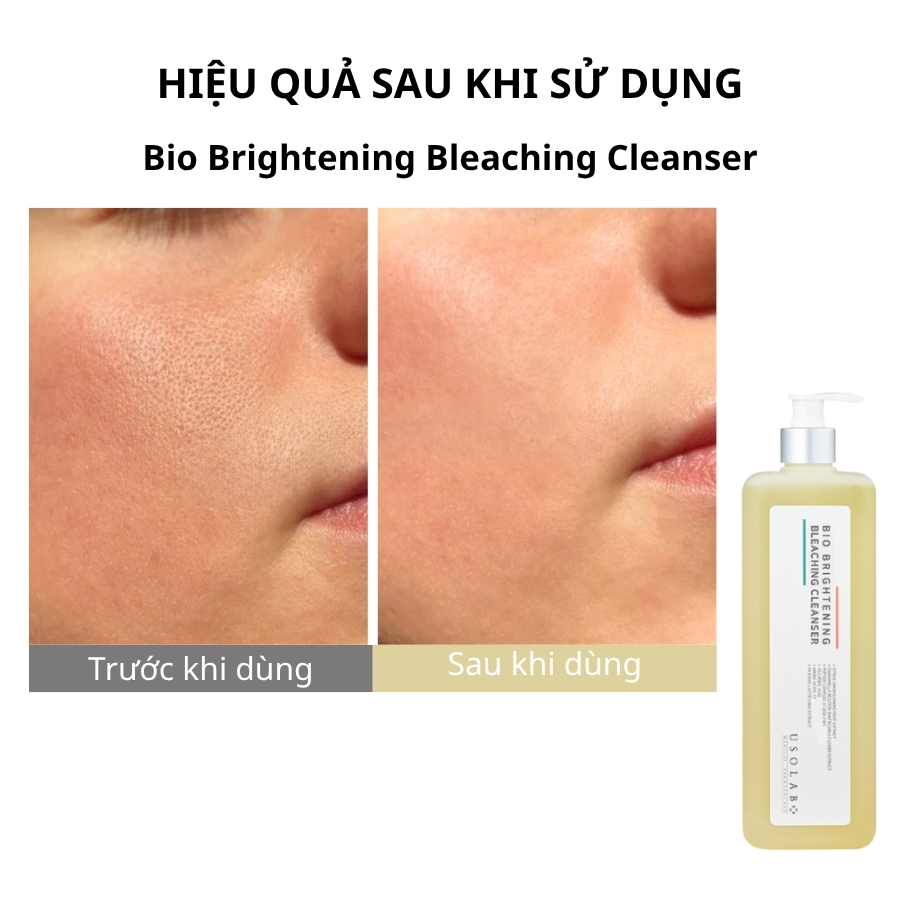 Sữa rửa mặt Bio Brightening Bleaching Cleanser 1000ml