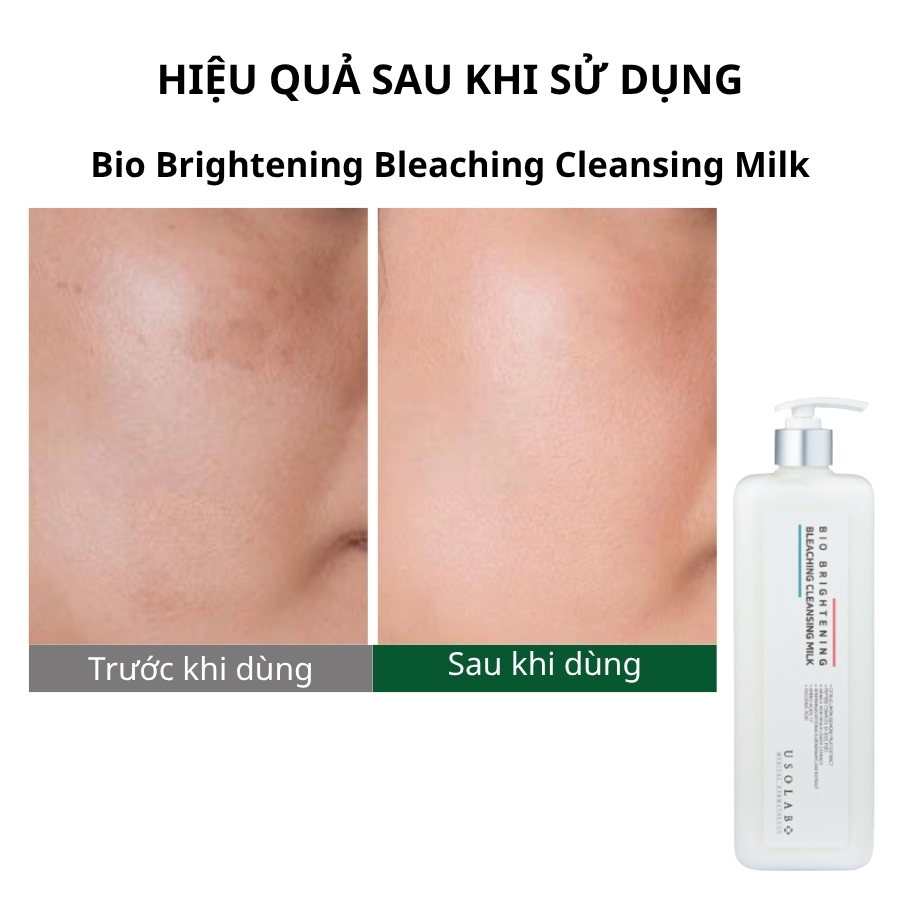 Tẩy trang Bio Brightening Bleaching Cleansing Milk 1000ml