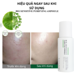 BIO SENSITIVE PURIFYING AMPOULE