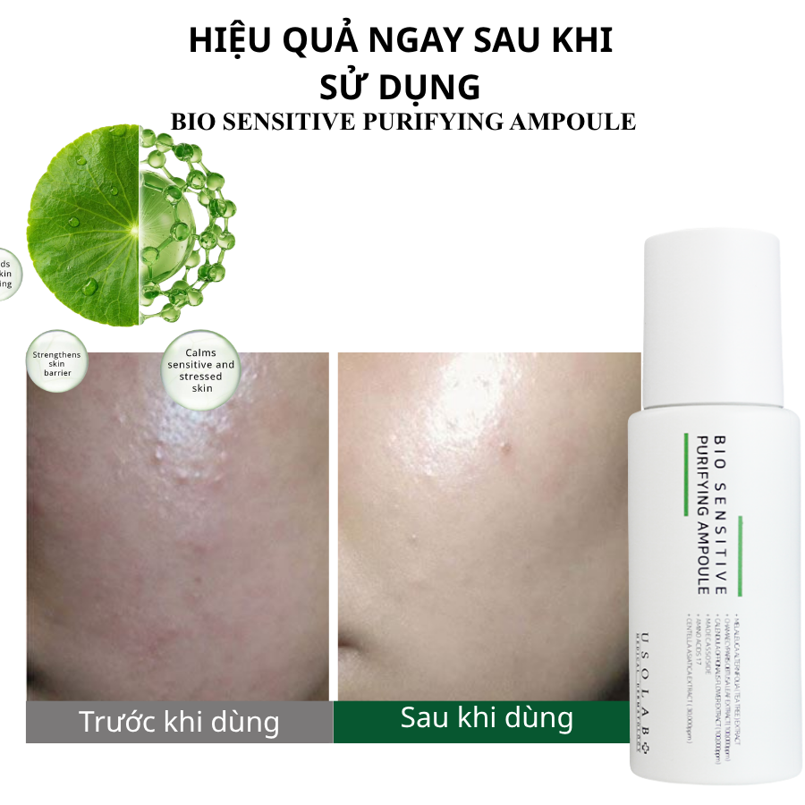 BIO SENSITIVE PURIFYING AMPOULE