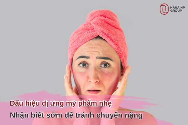 dấu hiệu dị ứng mỹ phẩm nhẹ