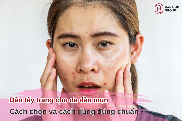 Dầu tẩy trang cho da dầu mụn