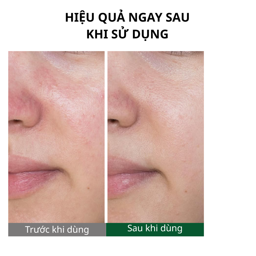 Bio Renaturation Repair Premium Mask Pack