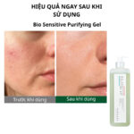 Bio Sensitive Purifying Gel 1000ml