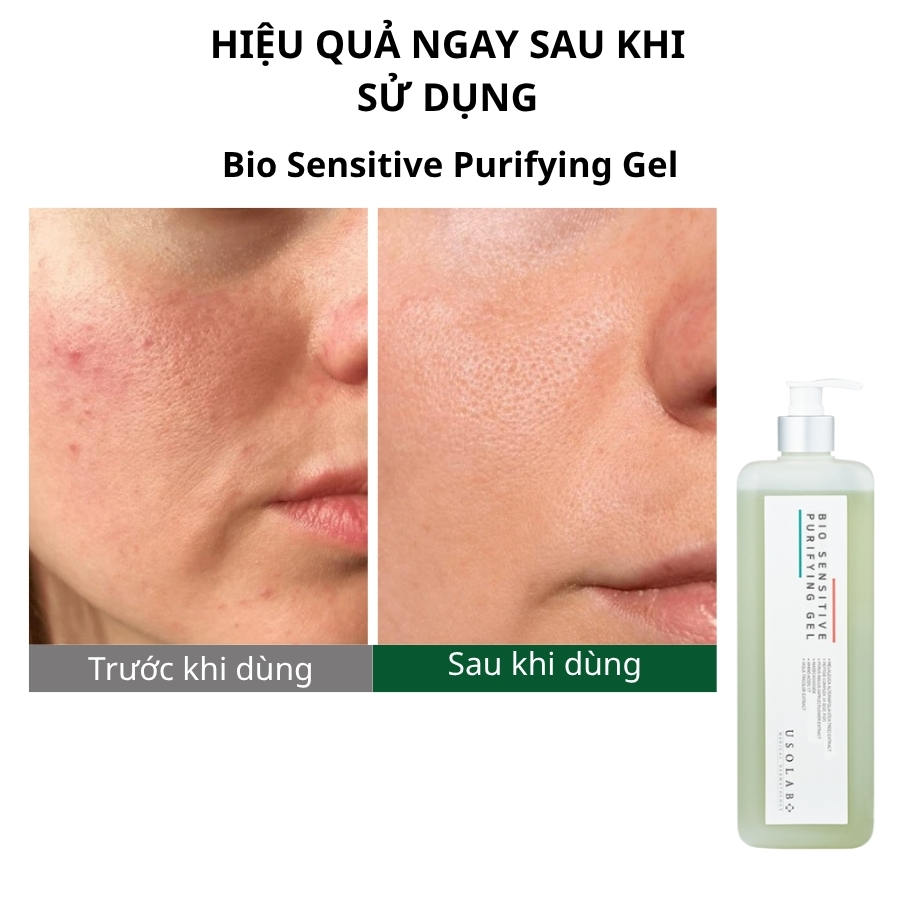 Bio Sensitive Purifying Gel 1000ml