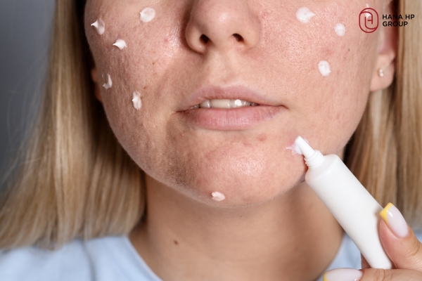 Da treatment cần các sản phẩm lành tính, dịu nhẹ, tập trung hỗ trợ phục hồi Da treatment cần các sản phẩm lành tính, dịu nhẹ, tập trung hỗ trợ phục hồi