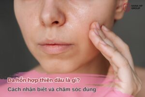 Da hỗn hợp thiên dầu là gì