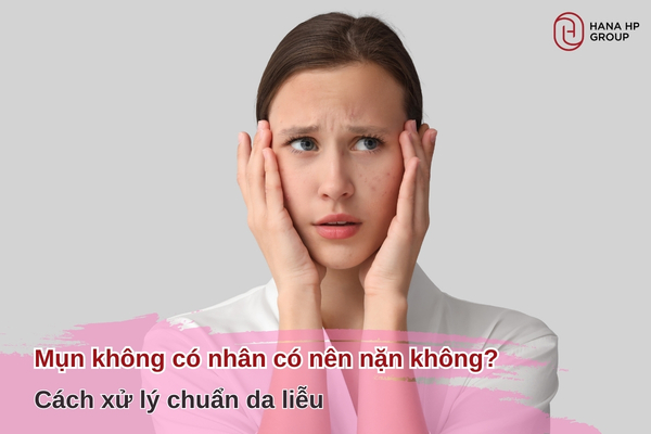 Mụn không có nhân có nên nặn không? Cách xử lý chuẩn da liễu 5 mụn không có nhân
