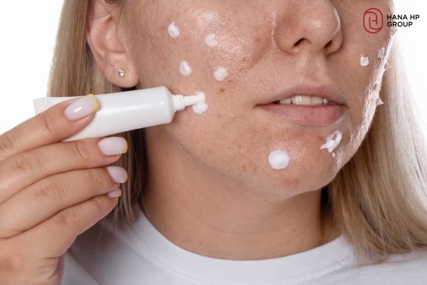 mặt bị nổi mẩn đỏ và ngứa phải làm sao