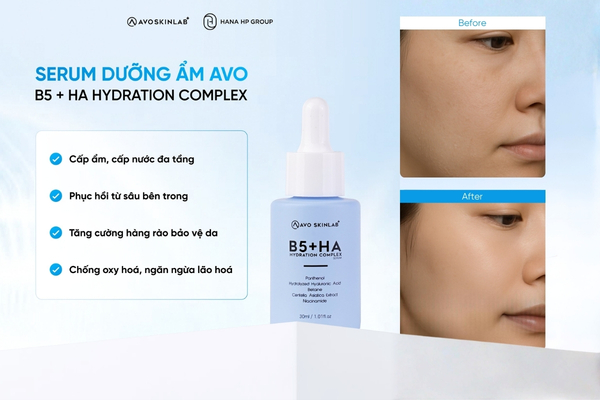 dùng AHA BHA PHA có bị đẩy mụn không