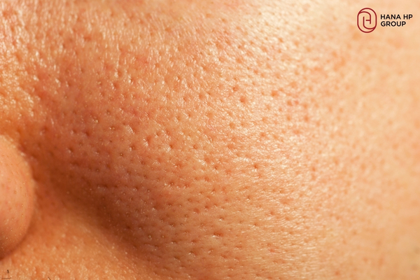 cách sử dụng BHA