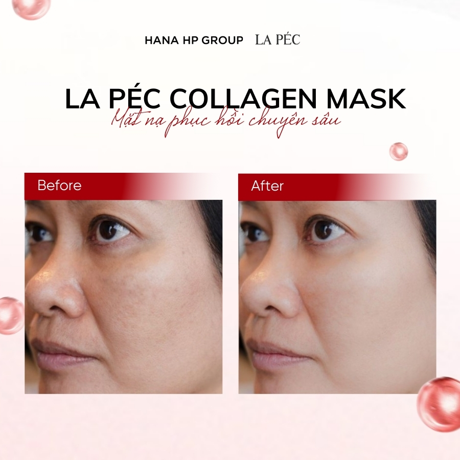 La Péc Collagen Mask