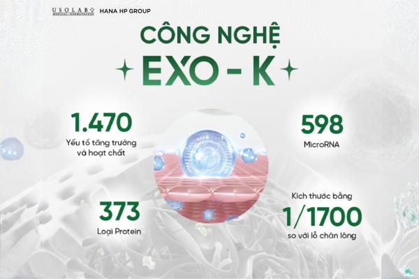 Công nghệ EXO-K độc quyền của Usolab