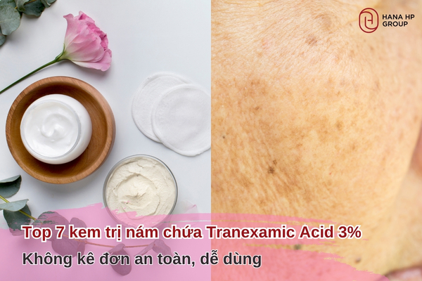 Top 7 kem trị nám chứa Tranexamic Acid 3% không kê đơn