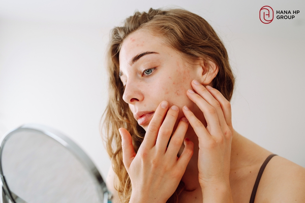 Da nhạy cảm, da sau xâm lấn đều có thể dùng serum B5