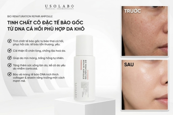 Tinh chất trẻ hóa da Usolab Bio Renaturation Repair Ampoule Tinh chất trẻ hóa da Usolab Bio Renaturation Repair Ampoule