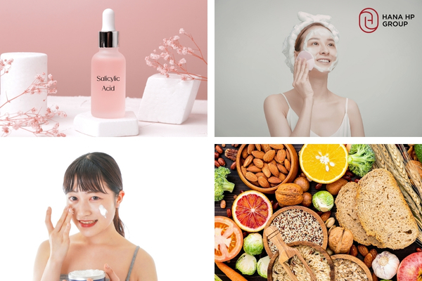 Dùng Salicylic Acid, kết hợp làm sạch da và ăn uống khoa học sẽ giúp cải thiện da mụn