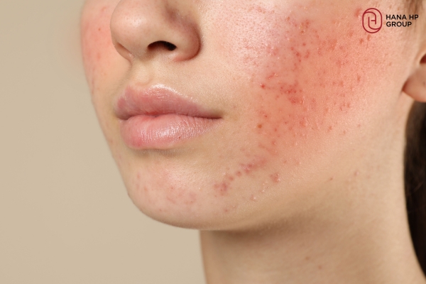 kinh nghiệm xài kem trộn body
