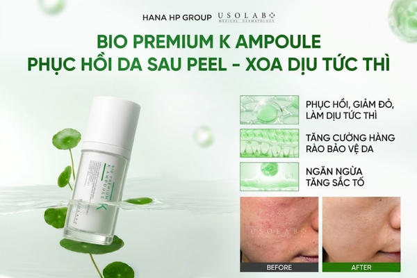 Tinh chất Usolab Bio Premium K Ampoule