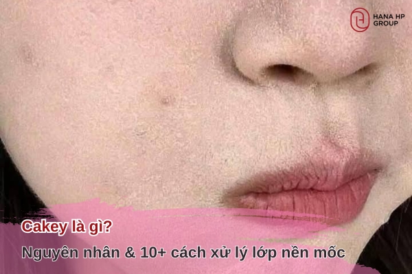Cakey là gì