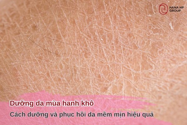 dưỡng da mùa hanh khô