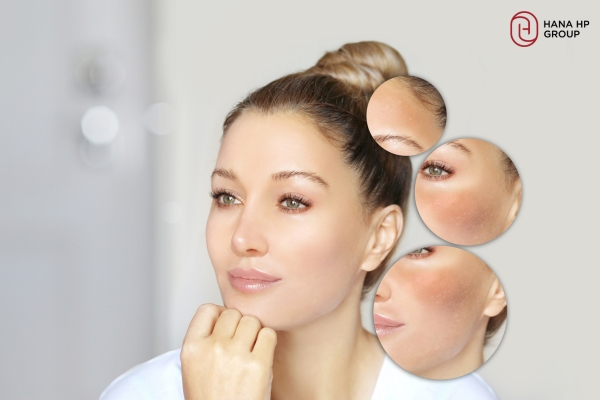 Kem dưỡng da có chứa Retinol có tốt không? Chuyên gia giải đáp 2 Kem dưỡng da có chứa Retinol