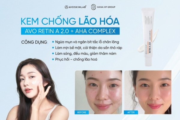 Kem dưỡng da có chứa Retinol có tốt không? Chuyên gia giải đáp 4 Kem dưỡng da có chứa Retinol