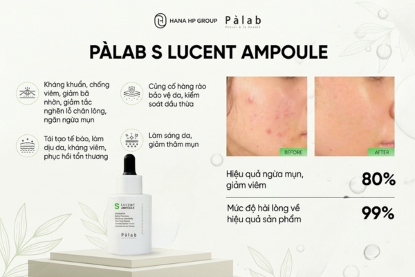 làm sao biết mình bị mụn nội tiết
