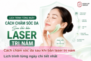 cách chăm sóc da sau khi bắn laser trị nám