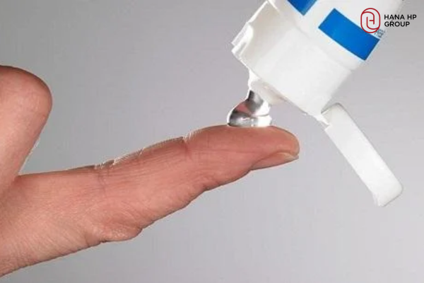 mụn mọc quanh miệng và cằm ở nữ giới