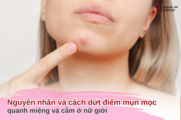 mụn mọc quanh miệng và cằm ở nữ giới