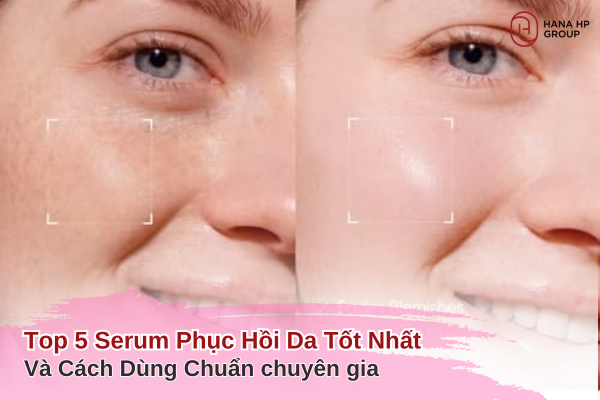 serum phục hồi da tốt nhất