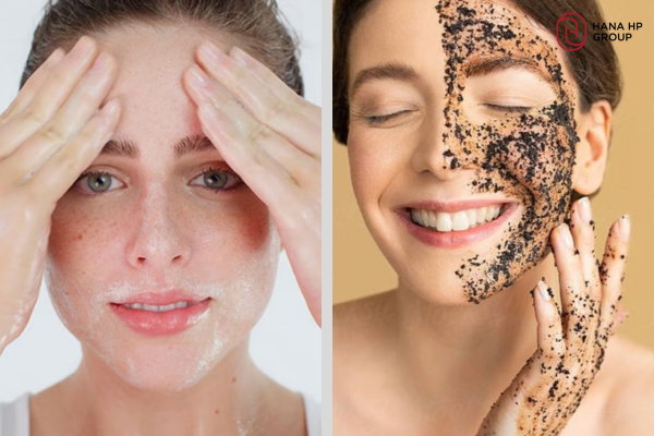 sau peel da bao lâu thì tẩy da chết