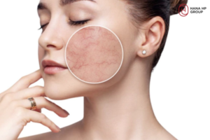 bã cà phê tẩy da chết mặt được không