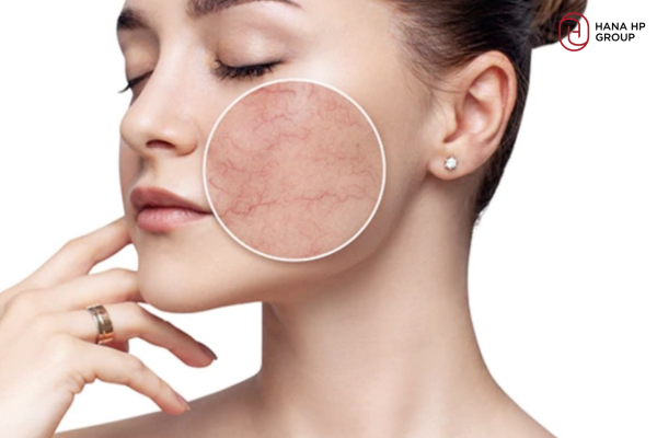bã cà phê tẩy da chết mặt được không