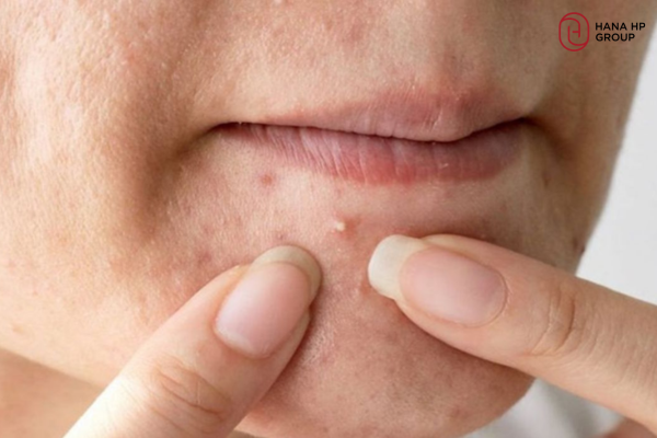 tẩy da chết xong có nên rửa mặt không