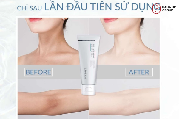 kem dưỡng trắng da mặt cho da ngăm đen